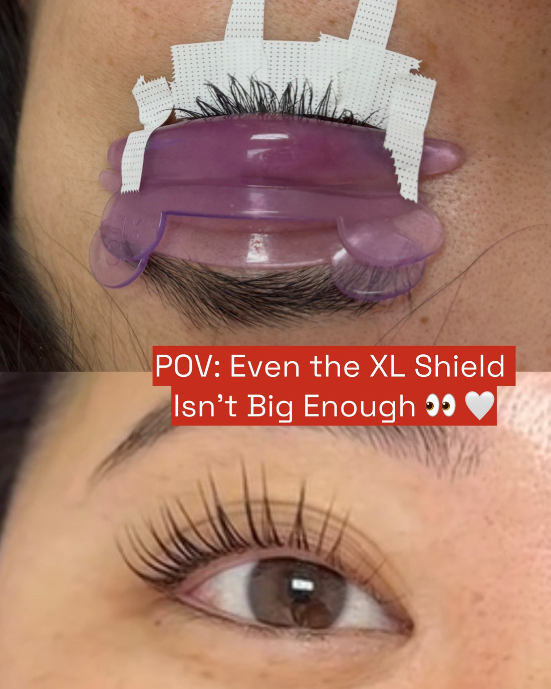 Two lash lift shields stacked together on a client with long lashes to create a thicker shield and prevent over-curling